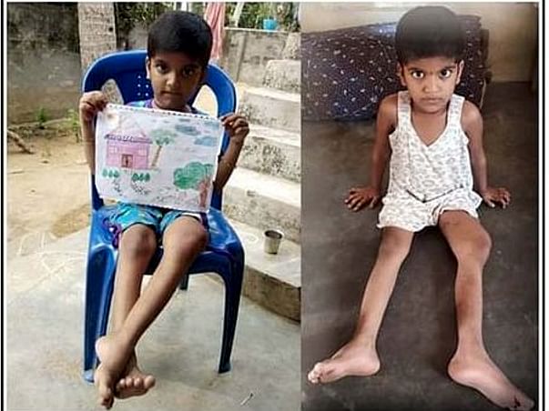 6 Years Old Geethika Saranya Needs Your Help Fight Bone Neoplasm
