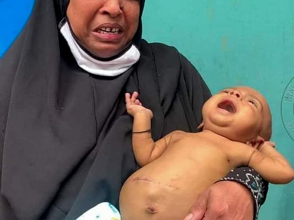 Please help him to transplant kidney#Urgent#Baby is in critical Stage.