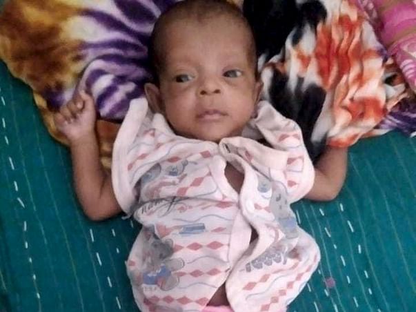 2 months old Baby of Reena needs your help fight eye disease