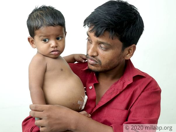 Street Vendor Struggles To Save His 1-Year-Old From Failing Liver
