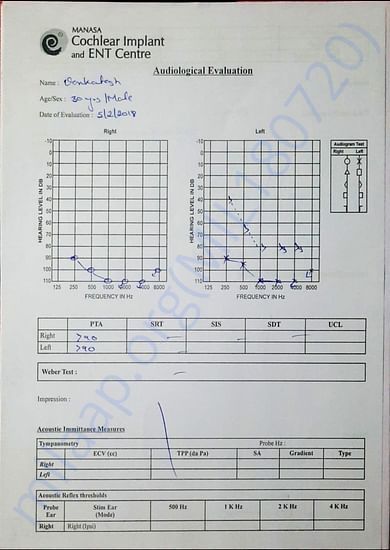 Audiology report