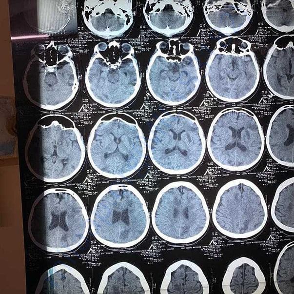 Medical Report