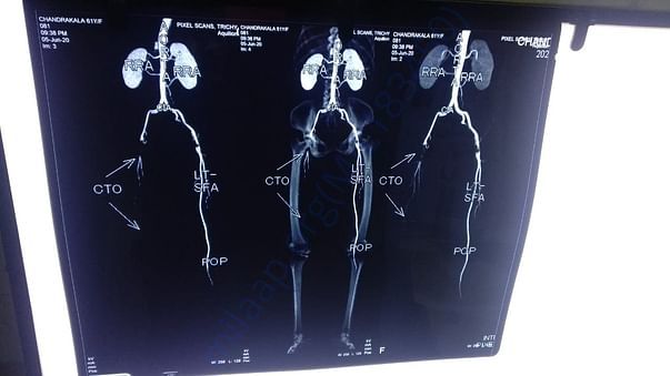 CT Scan Photocopy