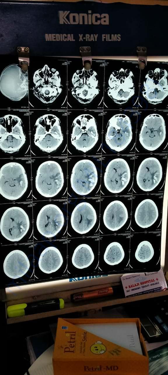 MRI