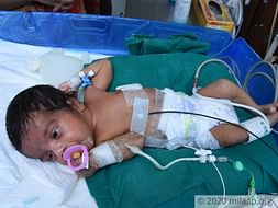 My 1 month old baby is in the ICU and need your support to survive