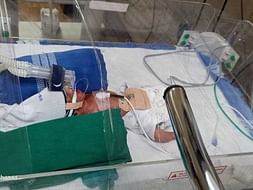 Our 1-day-old Baby Needs Your Help Fight against extreme pre maturity.