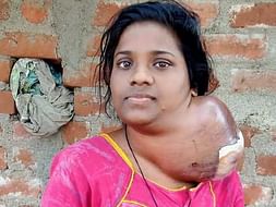Support Manabothula Sujatha Recover From lymphoma Cancer