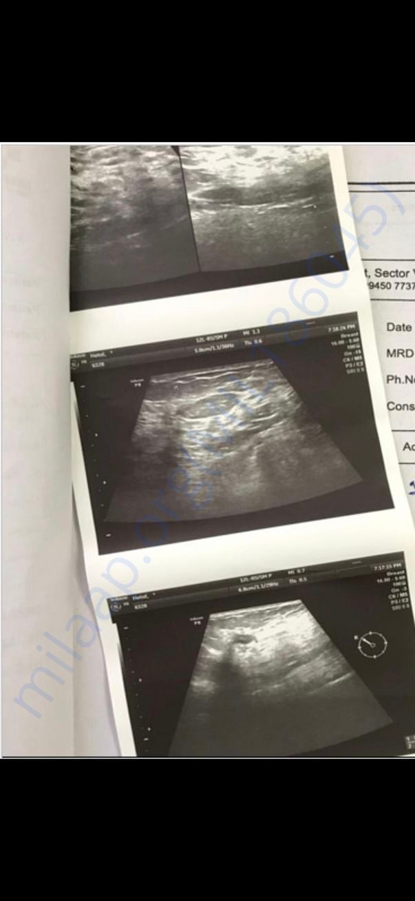 Sonography Report