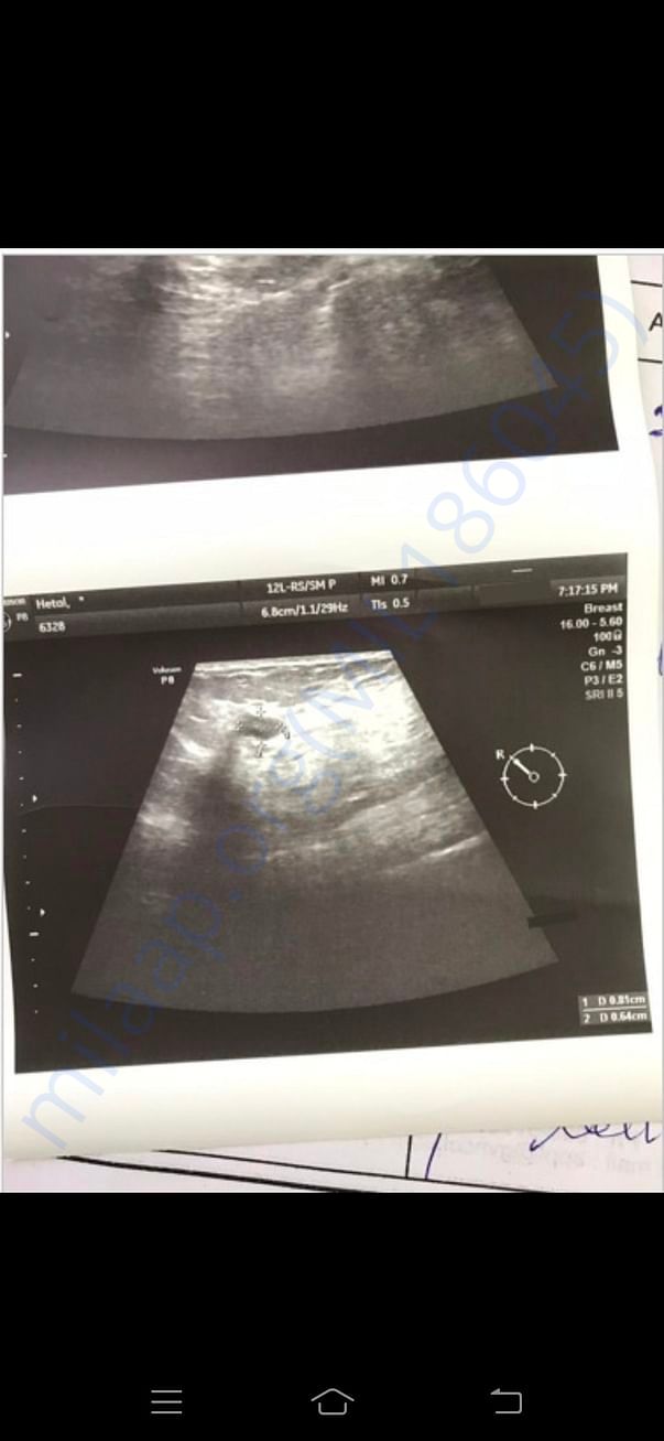 Sonography Report 2