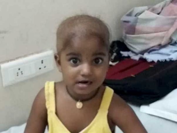 Help Baby pavani fight Cancer