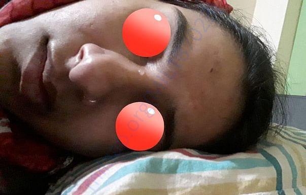 Given money for the treatment of Bells Palsy