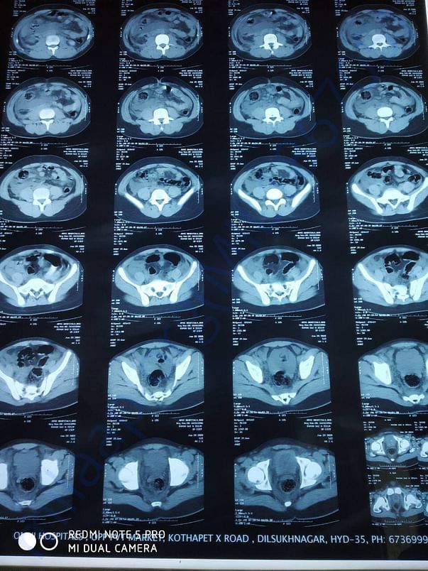 Scan Docs
