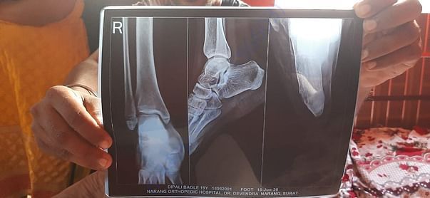 X-Ray