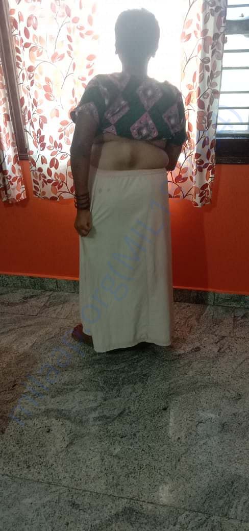 Photo of the deformity