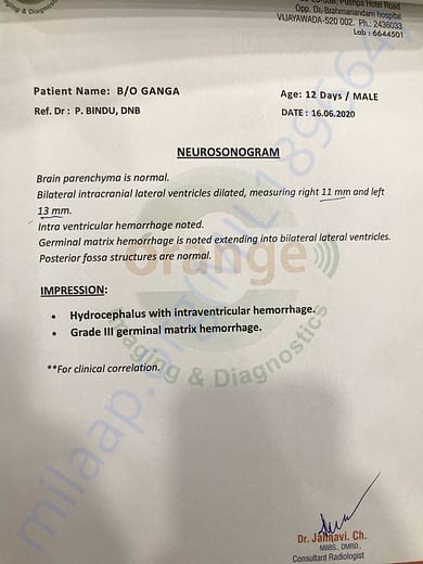 Neurosonogram