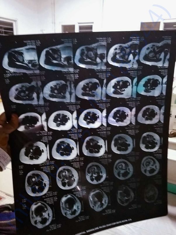 CT &Mri