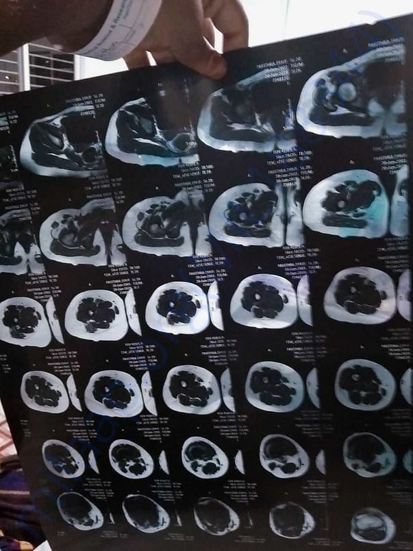 CT &Mri