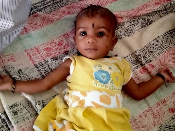 6 months old baby need a heart surgery