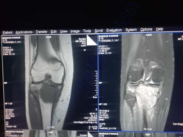 xray