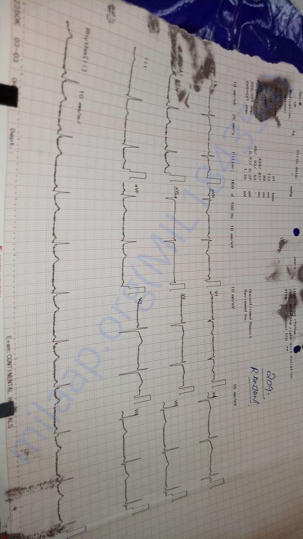 Ecg report