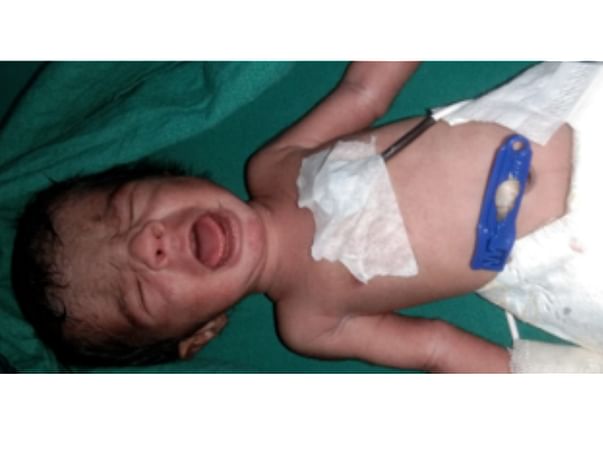 1 Day Old Baby Needs Your Help To Survive