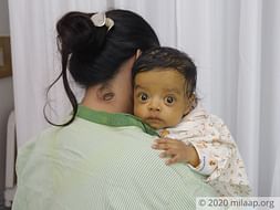 3 months old baby of madhusudan needs your help fight Biliary Atresia