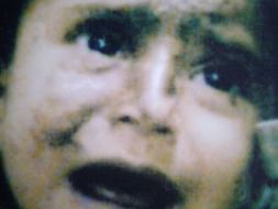 Support Acid Attack Victim Alina Baig For Her Education