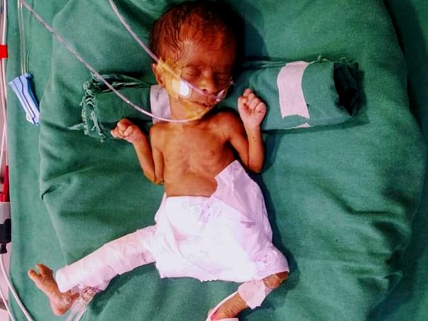 My new born baby is in the ICU and need your help to survive