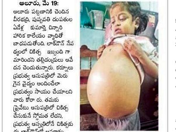 #SaveHarika to Undergo Liver Transplant