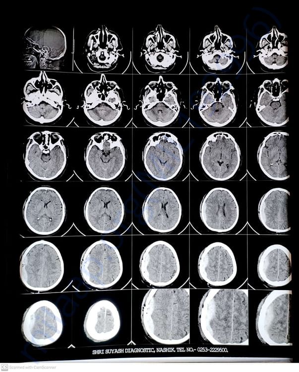 Head X-Ray