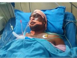 Support Surya Narayana Murthy Recover From Accident Head Injury