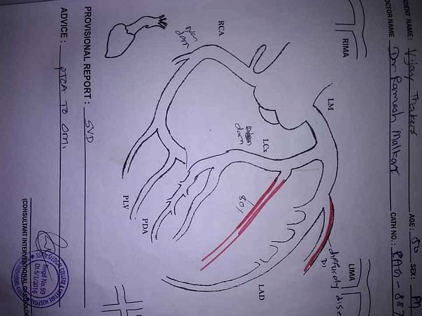 Help Me to Undergo Angioplasty Surgery
