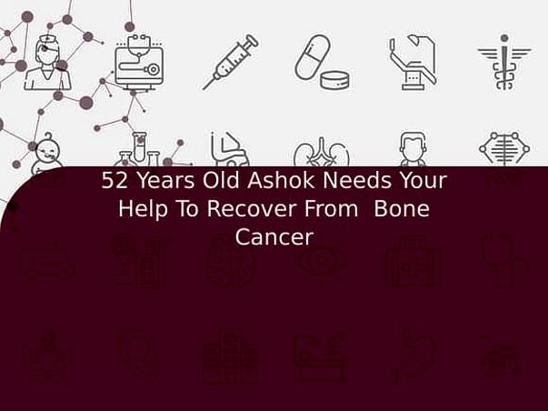 52 Years Old Ashok Needs Your Help To Recover From Bone Cancer
