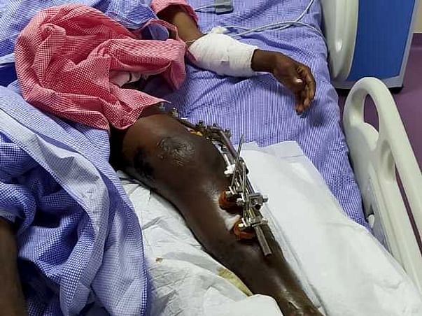 Support Bharath Recover From Accidental Injuries