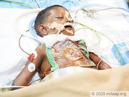 My 5 year old son is battling for his life in the ICU and needs your support