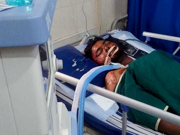 30 years old M. Sudheer Kumar needs your help fight Road traffic accident with polytrauma