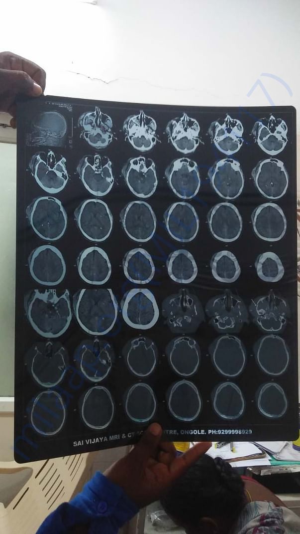 Brain Scan