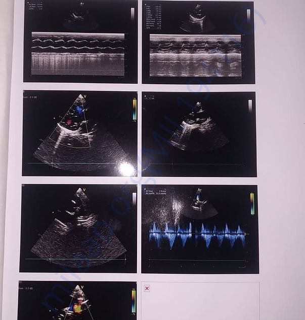 Diagnose Report