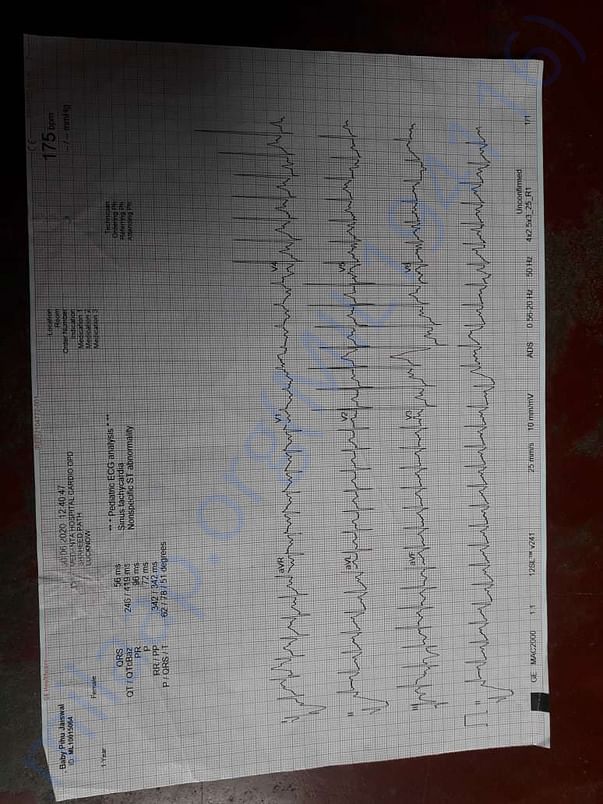 ECG Report