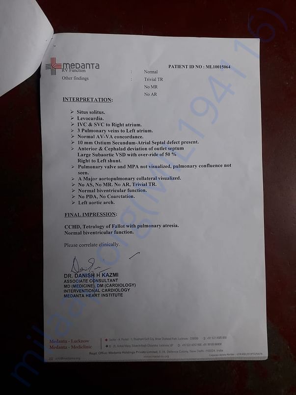 ECO Cardiology Report Interpretation