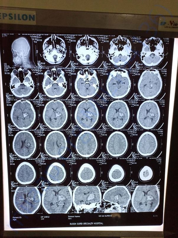 X-ray
