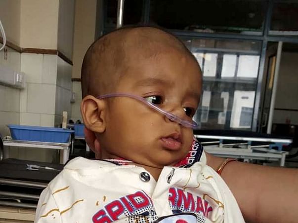 5 Months Old Ramneet Singh Needs Your Help Fight Bilary Artesia