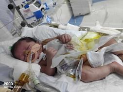 "Baby of Heena"has gone through multiple interstine surgeries,Help Her