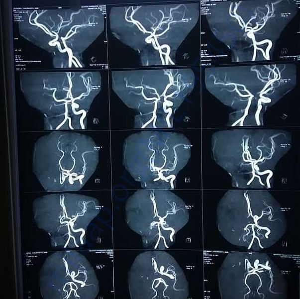 Medical Report