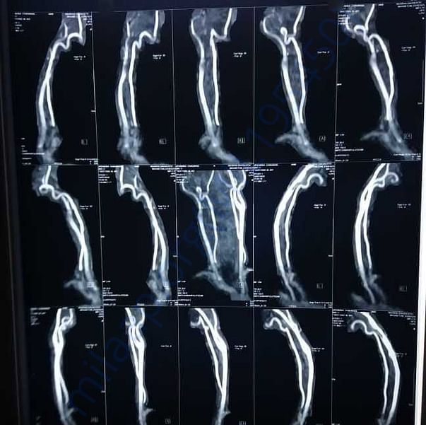 Medical Report