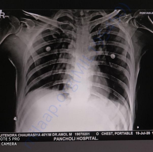 Medical Report