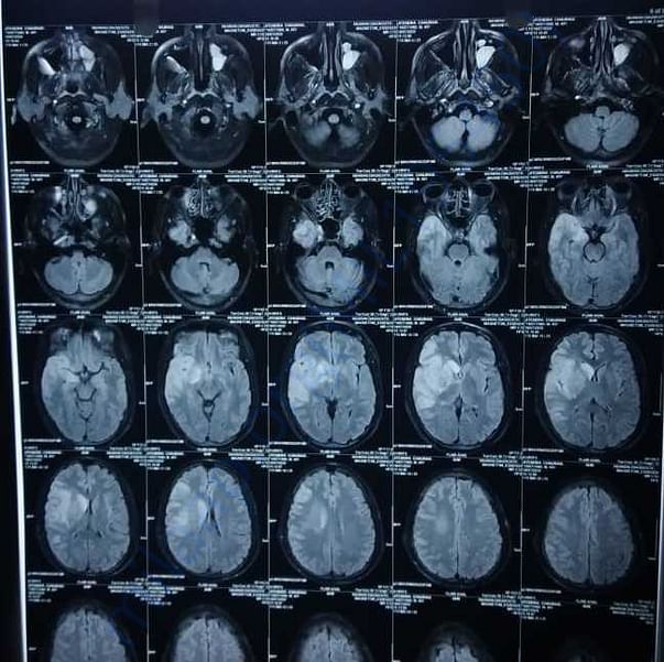 Medical Report