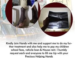 Lifting Up with Hands of Help