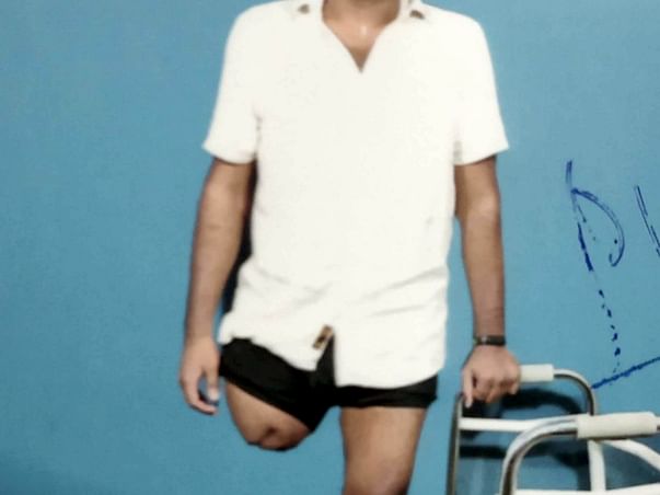 Help Me With My Artificial Leg Implantation