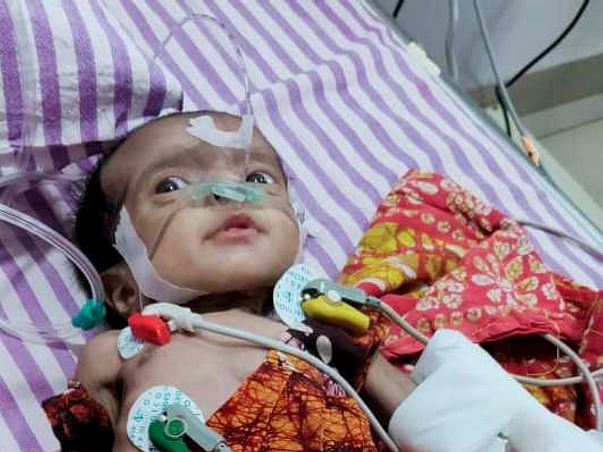 2 months old Samridhi Saha needs your help fight Arterioventricular septal defect